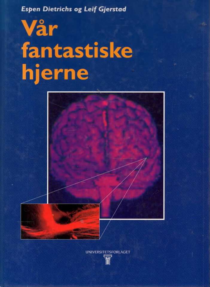 Vår fantastiske hjerne