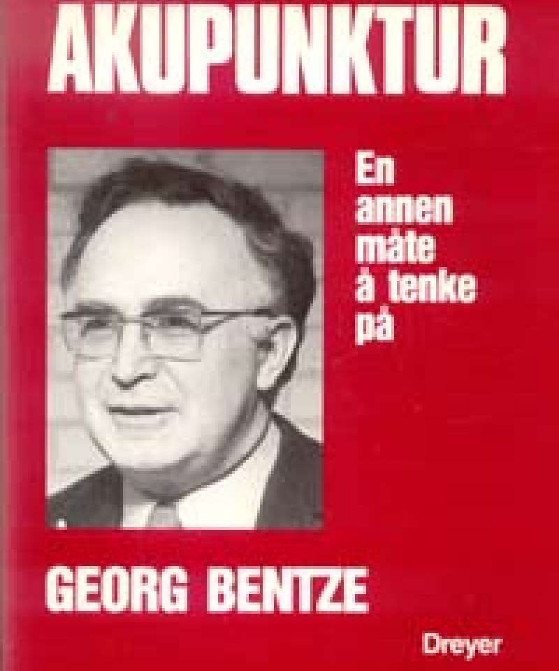 Akupunktur